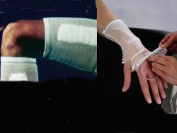 Fiksirne mrežice za obloge in IV kanal